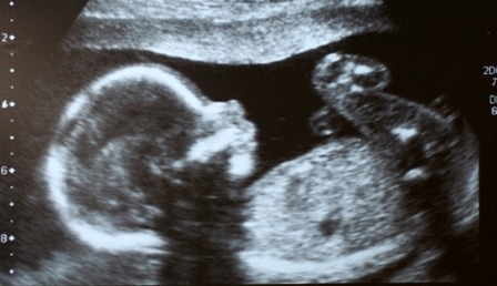 82350.jpg
