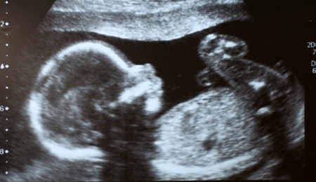 Aborcja.jpg