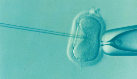 ivf-1514174_1920-e1666702381757.png