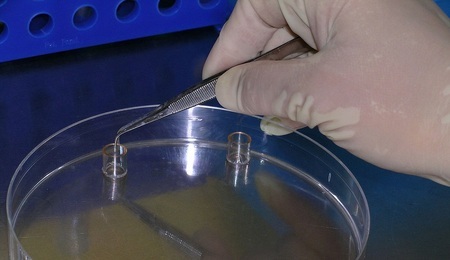 1200px-Human_cell-line_colony_being_cloned_in_vitro_through_use_of_cloning_rings.jpg
