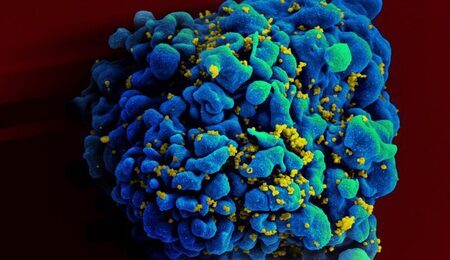 HIV-infected_H9_T_cell_6813396647-e1733989789895.jpg