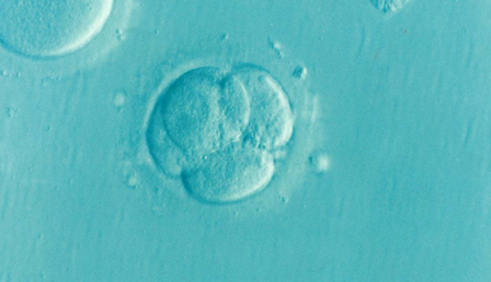 embryo-1514192_1280-e1710402794694.png