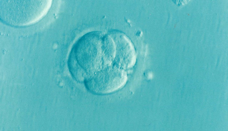 embryo-1514192_1280-e1710402794694.png
