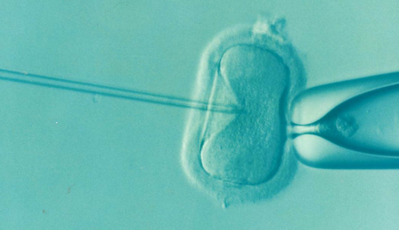Ivf-e1740038218372.png
